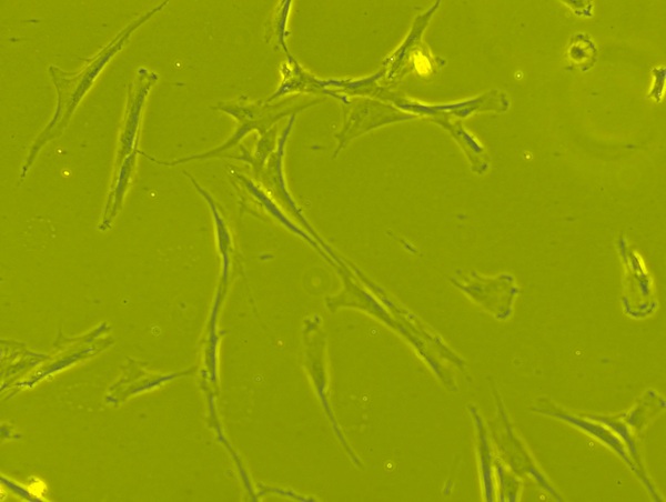 Conversion of Mesenchymal Stem Cells to Cancer-Associated Fibroblasts in a Tumor Microenvironment: An <em>in vitro</em> Study