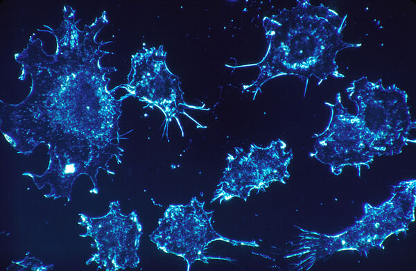 Combating drug resistance in cancer cells: Cooperative effect of green tea and turmeric with chemotherapeutic drug