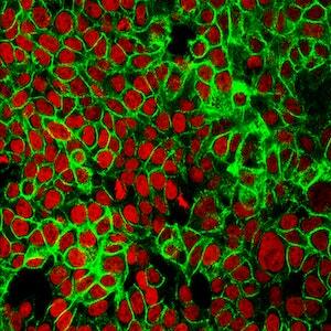 Inhibiting the ERK pathway and the TRPM7 ion channel in gastric and bladder cancer cells