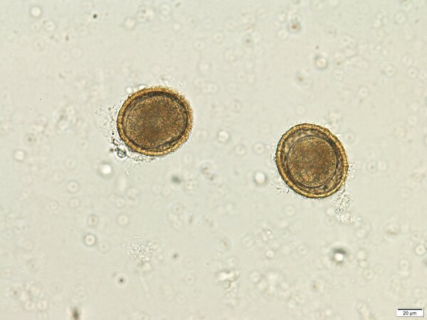 The Prevalence of Brain-Eating Roundworm <i>Baylisascaris procyonis</i> in Merrick County, Nebraska