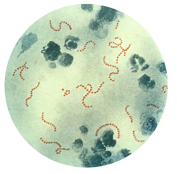 The Development of a Highly Sensitive Home Diagnosis Kit for Group A Streptococcus Bacteria (GAS)