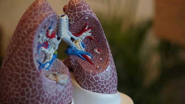 VISTA inhibitor CA170 combined with <i>KRAS</i> vaccine enhances immune response in lung cancer